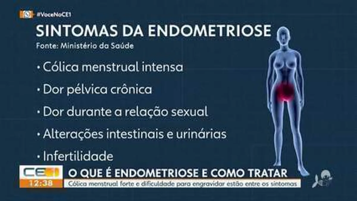 Registro fotográfico documental de Avanços científicos e resgate histórico jogam luz sobre a endometriose: como a medicina tenta reparar séculos de negligência - Foto: Reprodução / s01.video.glbimg.com
