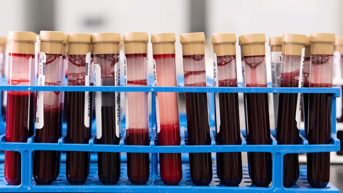Registro fotográfico documental de O teste de R$ 6.990 que busca 50 tipos de câncer no sangue chega ao Brasil, mas estudo aponta sensibilidade de 39% - Foto: Reprodução / Estadão